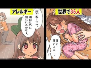 世界でわずか35人だけ、水アレルギーになるとどうなるのか。その実態をマンガにしてみた。