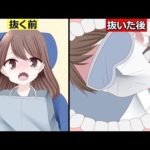 親知らずは抜くべきなのか?放置した方がいいのか?
