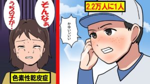 日本人に多い難病！！色素性乾皮症とは？【マンガで分かる】