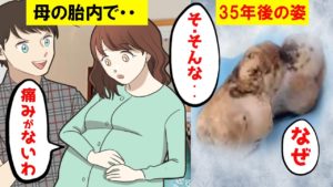 (実話漫画)母親の胎内で35歳になって産まれたストーンベビーの謎…