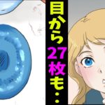 【漫画】「なんで・・」目の中から27枚ものコンタクトレンズが発見された→どうしてこんな事に・・