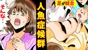 【漫画】人魚症候群として生まれて来た少女の短い人生‥