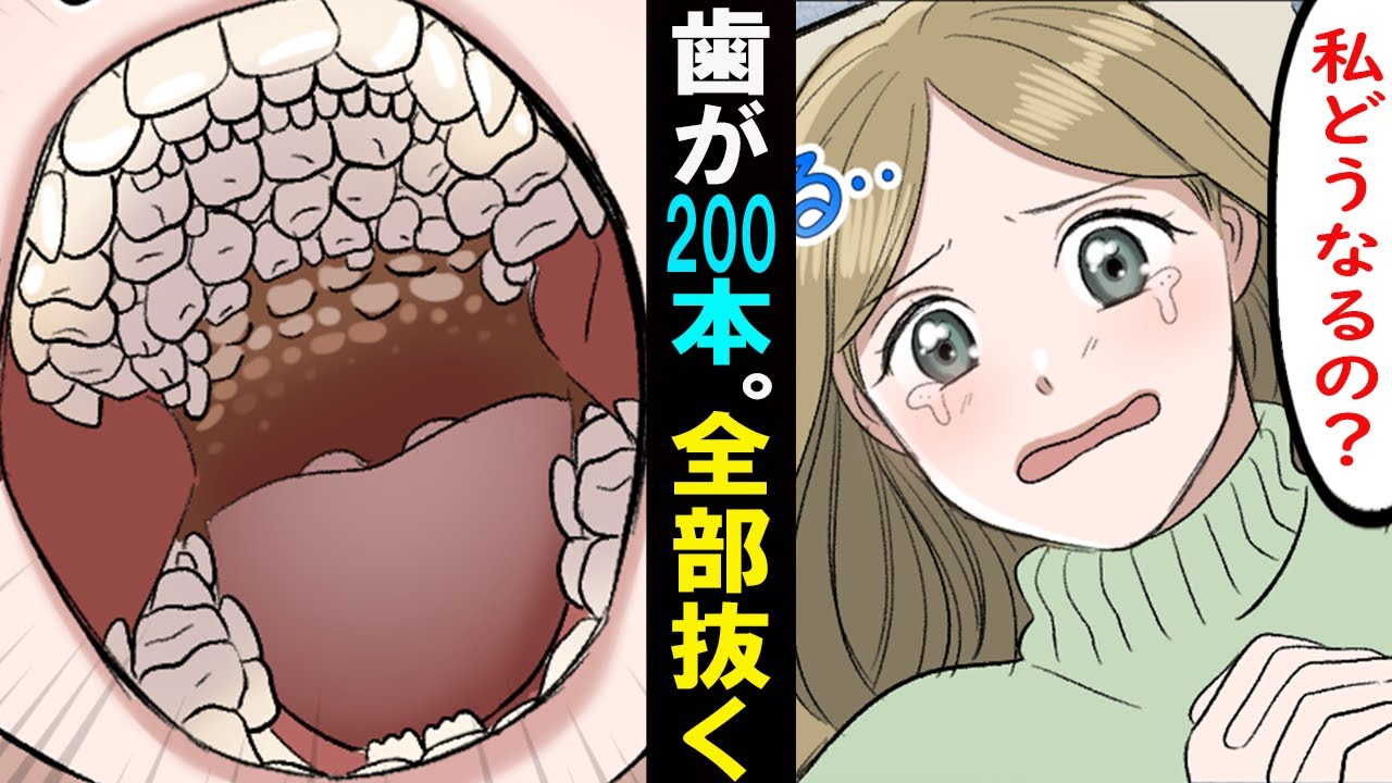 【漫画】歯が200本も生えて来た女。全部抜く事になったがどうしてこんな事に･･。