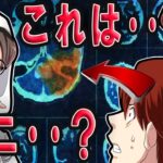 余命1年の叔母→CT画像に人のような影が…?【怖い話】