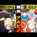 【実話】生まれつき体の色素を作りづらい難病「アルビノ」…東アフリカでは高額取引され…