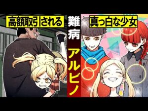 【実話】生まれつき体の色素を作りづらい難病「アルビノ」…東アフリカでは高額取引され…